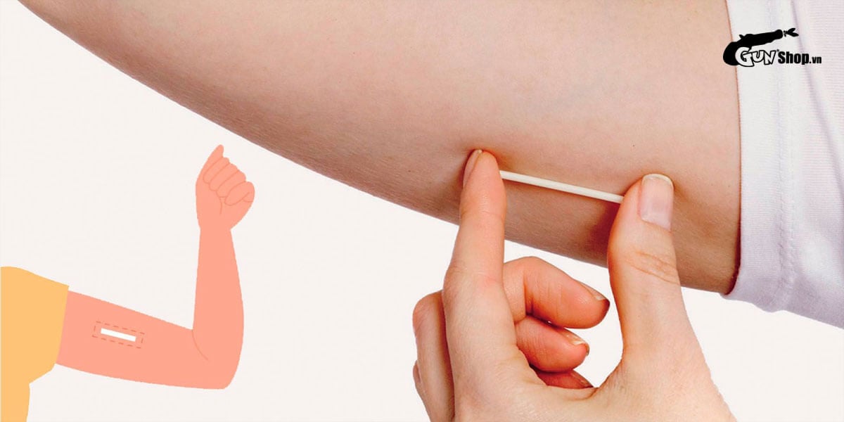 Đặt vòng tránh thai vào cánh tay của bạn