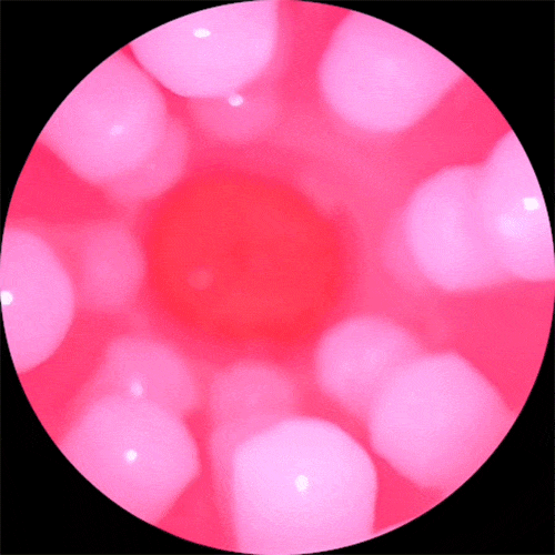 Cấu trúc nhú điển hình của NPG Miiko